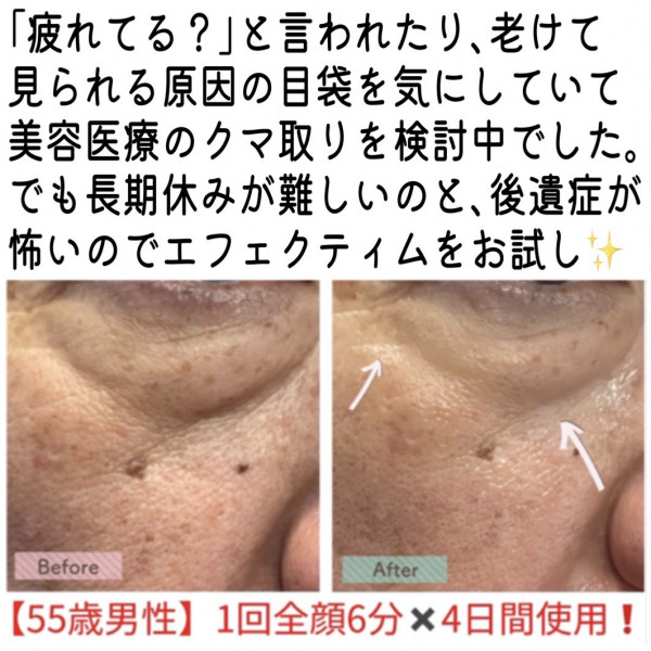 エフェクティム スムース ビューティー リフティング アクティベーター