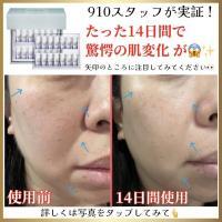 最短で最強の美白美容液をスタッフが14日間モニター。驚愕の結果が!