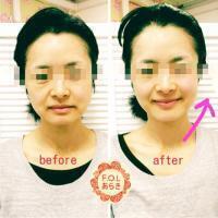 自分にご褒美クリスマスエステ